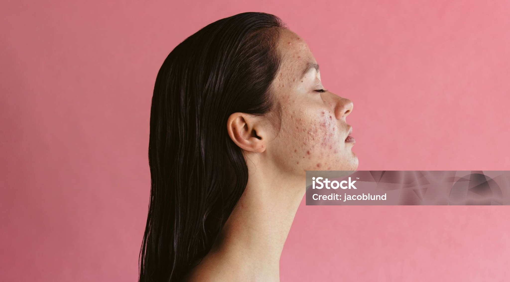 istockphoto-1331273189-2048×1134-modified